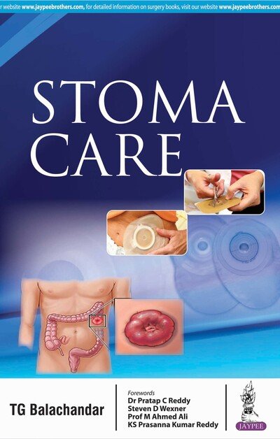 Cover for TG Balachandar · Stoma Care (Paperback Book) (2018)