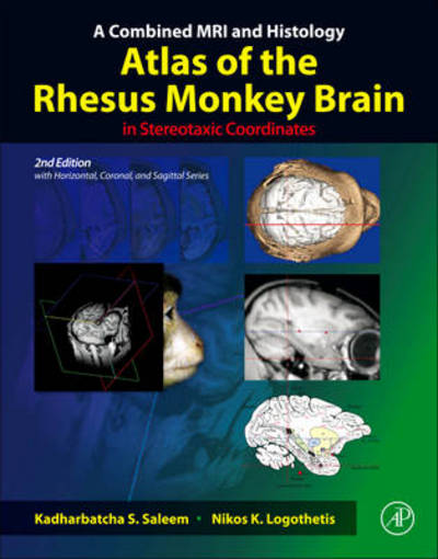 Cover for Saleem · A Combined MRI and Histology Atl (Book) (2012)