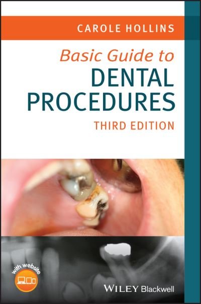 Hollins, Carole (British Dental Association) · Basic Guide to Dental Procedures - Basic Guide Dentistry Series (Paperback Book) (2024)