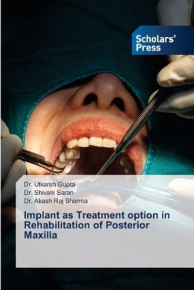 Cover for Gupta · Implant as Treatment option in Re (N/A) (2021)