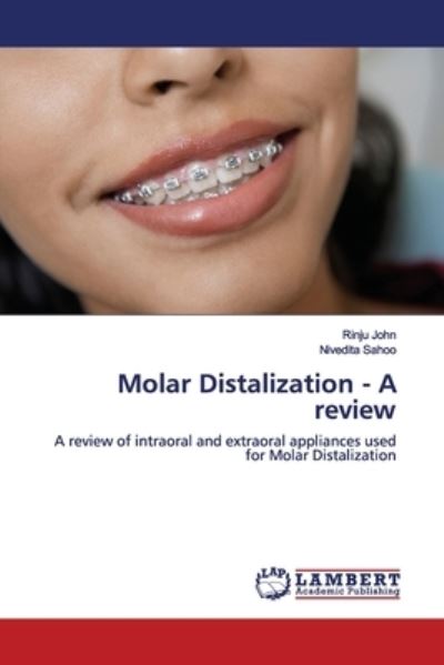 Molar Distalization - A review - John - Books -  - 9786139448876 - February 15, 2019