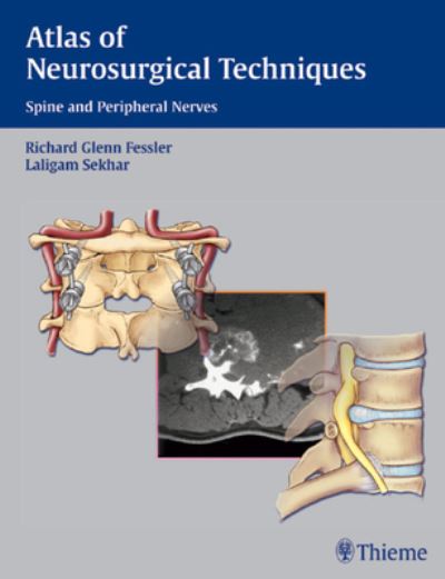 Cover for Richard Glenn Fessler · Atlas of Neurosurgical Techniques (Book) (2006)