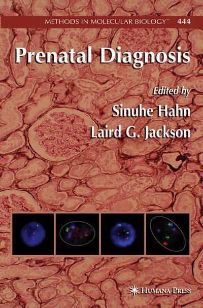 Cover for Sinuhe Hahn · Prenatal Diagnosis - Methods in Molecular Biology (Paperback Book) [Softcover reprint of hardcover 1st ed. 2008 edition] (2010)