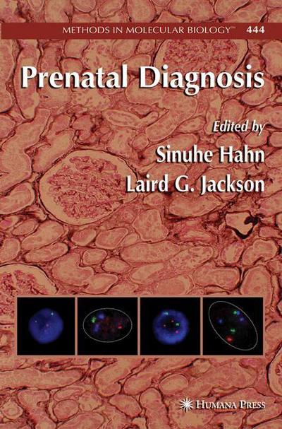 Prenatal Diagnosis - Methods in Molecular Biology - Sinuhe Hahn - Books - Humana Press Inc. - 9781617377877 - November 19, 2010