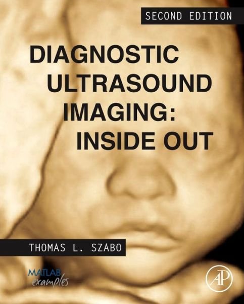 Diagnostic Ultrasound Imaging: Inside Out - Biomedical Engineering - Szabo, Thomas L. (Research Professor, Department of Biomedical Engineering, Boston University, Boston, MA, USA) - Livros - Elsevier Science Publishing Co Inc - 9780123964878 - 16 de dezembro de 2013