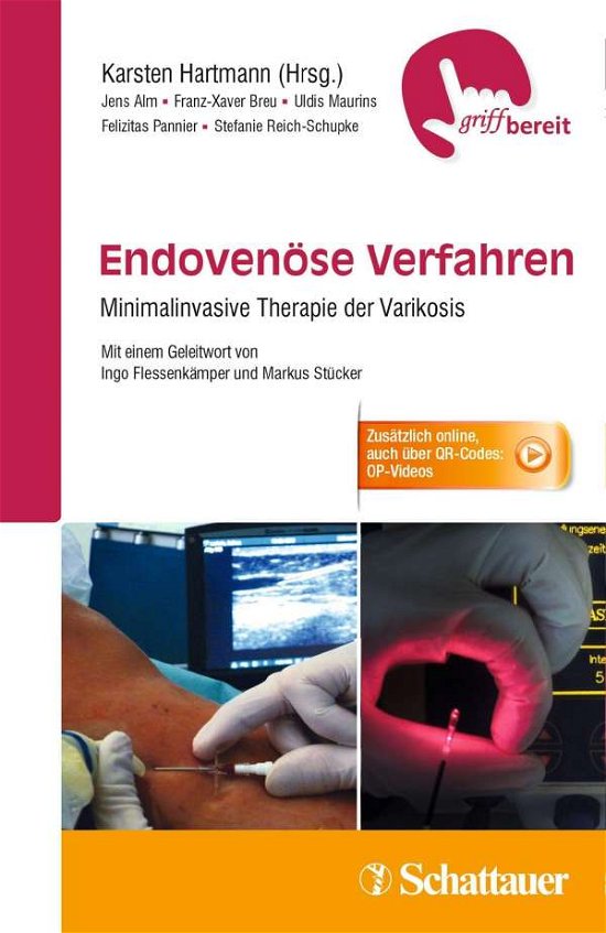 Cover for Alm · Endovenöse Verfahren (Bok)