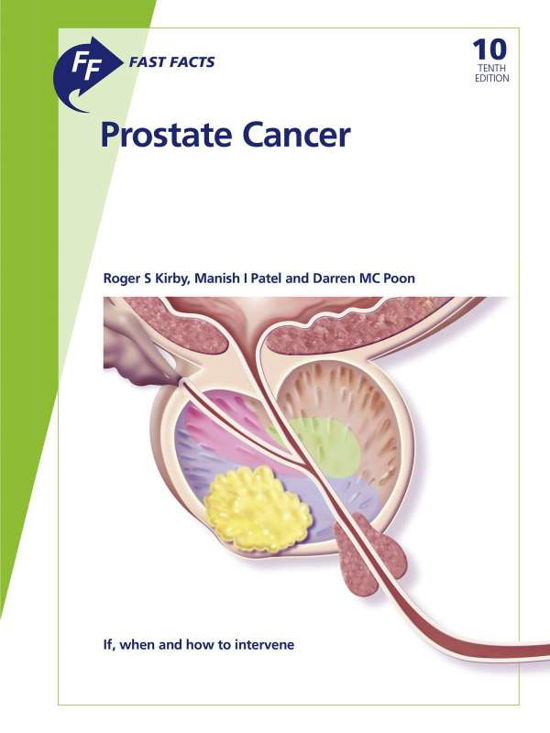 Cover for Kirby · Fast Facts: Prostate Cancer (Bok)