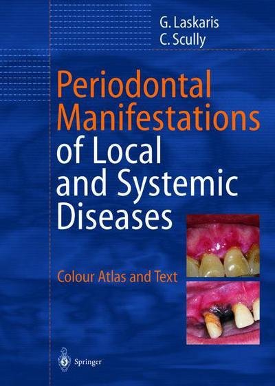 Cover for George Laskaris · Periodontal Manifestations of Local and Systemic Diseases: Colour Atlas and Text (Paperback Book) [Softcover reprint of the original 1st ed. 2003 edition] (2012)