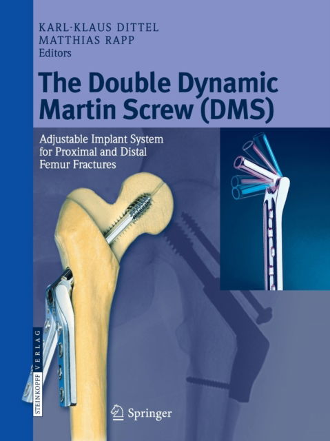 Cover for The Double Dynamic Martin Screw (DMS): Adjustable Implant System for Proximal and Distal Femur Fractures (Paperback Book) [Softcover reprint of the original 1st ed. 2008 edition] (2016)