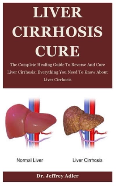 Liver Cirrhosis Cure: The Complete Healing Guide To Reverse And Cure Liver Cirrhosis; Everything You Need To Know About Liver Cirrhosis - Dr Jeffrey Adler - Bøker - Independently Published - 9798671929881 - 3. august 2020