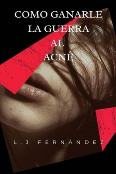 Cover for Luis Jesus Fernandez Gimeno · Como Ganarle la Guerra al Acne (Paperback Book) (2020)