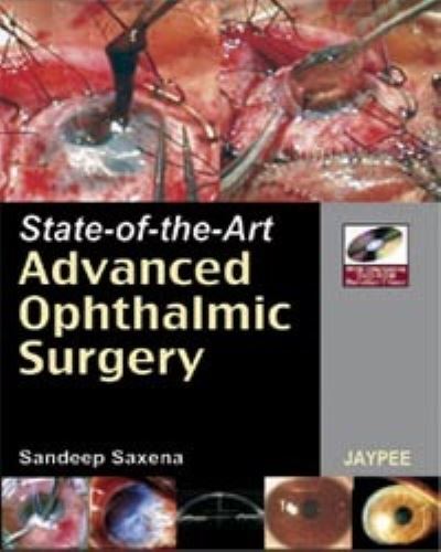 Cover for Sandeep Saxena · State-of-the-Art Advanced Ophthalmic Surgery (N/A) (2008)