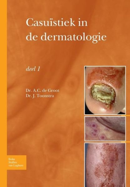 Cover for Anton C Groot · Casu?stiek in de Dermatologie - Deel I (Paperback Bog) [2009 edition] (2009)