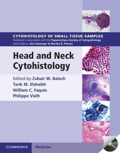 Cover for Zubair W Baloch · Head and Neck Cytohistology with DVD-ROM - Cytohistology of Small Tissue Samples (Book) (2014)