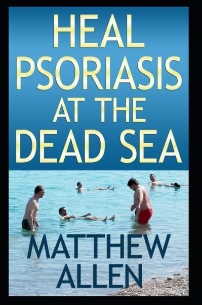 Heal Psoriasis at the Dead Sea - Matthew Allen - Książki - Independently Published - 9781724187888 - 11 października 2018