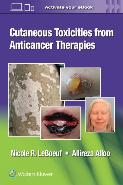Cutaneous Toxicities from Anticancer Therapies - Dr. Nicole LeBoeuf - Livres - Wolters Kluwer Health - 9781975157890 - 23 février 2023