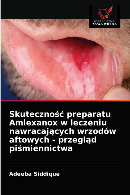 Skuteczno?c preparatu Amlexanox w leczeniu nawracaj?cych wrzodow aftowych - przegl?d pi?miennictwa - Adeeba Siddique - Books - Wydawnictwo Nasza Wiedza - 9786203347890 - February 24, 2021