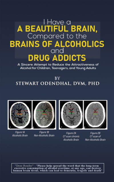 Cover for Odendhal, DVM, PhD, Stewart · I Have a Beautiful Brain, Compared to the Brains of Alcoholics and Drug Addicts: A Sincere Attempt to Reduce the Attractiveness of Alcohol for Children, Teenagers, and Young Adults (Paperback Book) (2024)