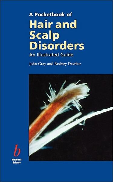 Cover for Gray · A Pocketbook of Hair and Scalp Disorders: An Illustrated Guide (Pocketbok) (1998)