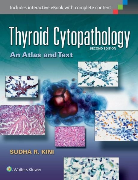 Cover for Sudha R. Kini · Thyroid Cytopathology: An Atlas and Text (Hardcover Book) (2015)