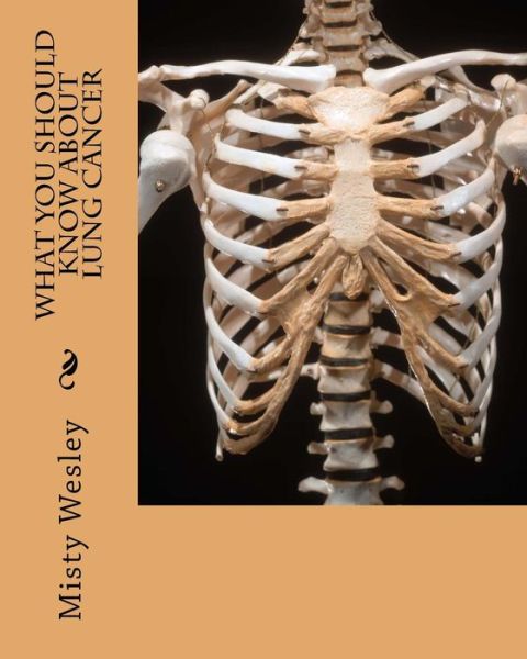 Cover for Misty L Wesley · What You Should Know About Lung Cancer (Paperback Book) (2014)