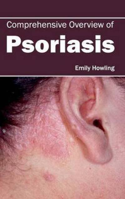 Cover for Emily Howling · Comprehensive Overview of Psoriasis (Hardcover bog) (2015)
