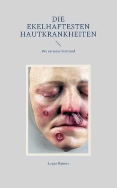 Cover for Logan Banner · Die ekelhaftesten Hautkrankheiten (Taschenbuch) (2022)