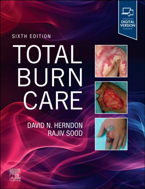 Cover for Total Burn Care (Hardcover Book) (2025)