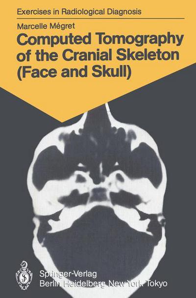 Cover for Marcelle Megret · Computed Tomography of the Cranial Skeleton (Face and Skull): 58 Radiological Exercises for Students and Practitioners - Exercises in Radiological Diagnosis (Paperback Book) [Softcover reprint of the original 1st ed. 1986 edition] (1986)
