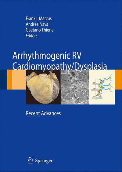 Cover for Arrhythmogenic RV Cardiomyopathy / Dysplasia: Recent Advances (Hardcover Book) [2007 edition] (2007)