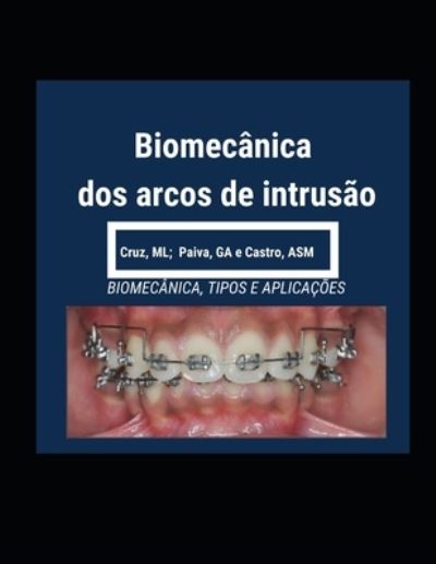 Cover for Glauci Paiva · Biomecanica dos Arcos de Intrusao (Paperback Book) (2023)