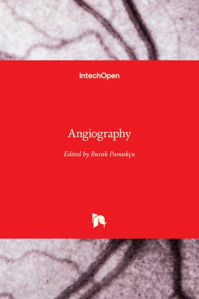 Cover for Burak Pamukcu · Angiography (Hardcover Book) (2019)
