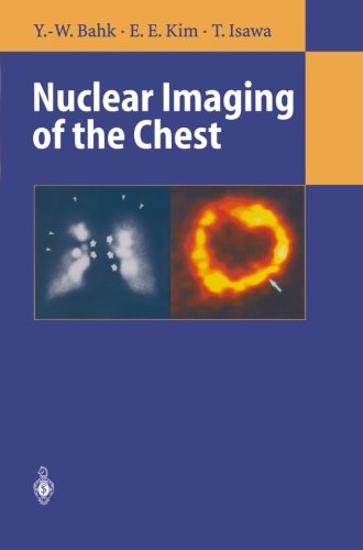 Nuclear Imaging of the Chest - Yong-Whee Bahk - Books - Springer-Verlag Berlin and Heidelberg Gm - 9783642803895 - October 3, 2013