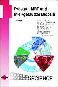 Cover for Blondin · Prostata-MRT und MRT-gestützte (Book)