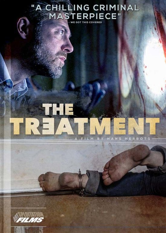 Cover for Treatment (DVD) (2015)