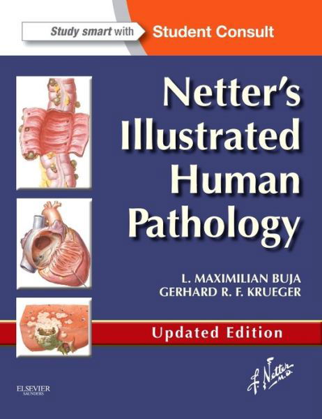 Cover for Buja, L. Maximilian, M.D. (Professor of Pathology and Laboratory Medicine at the University of Texas Health Science Center, Houston, TX, USA) · Netter's Illustrated Human Pathology Updated Edition: with Student Consult Access (Paperback Book) [Updated edition] (2013)