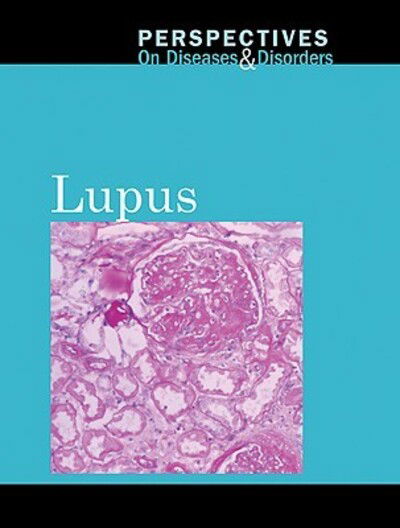 Cover for Hayley Mitchell Haugen · Lupus (Book) (2010)