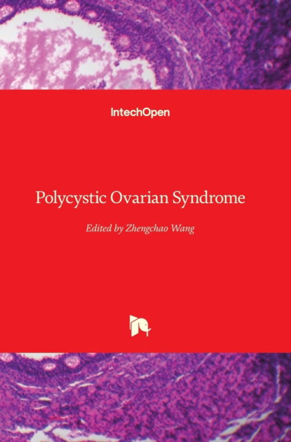 Cover for Zhengchao Wang · Polycystic Ovarian Syndrome (Innbunden bok) (2020)