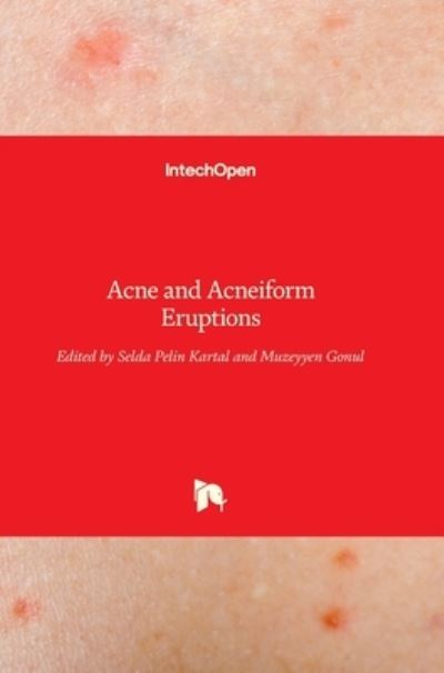 Cover for Selda Pelin Kartal · Acne and Acneiform Eruptions (Hardcover Book) (2017)