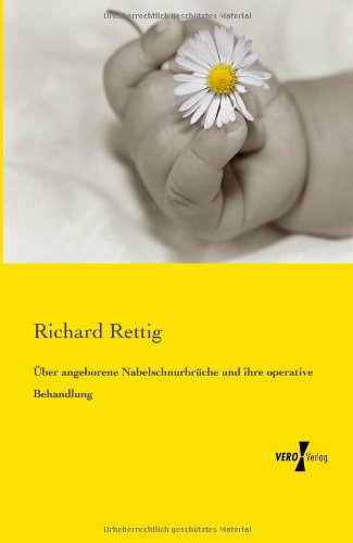 Cover for Richard Rettig · UEber angeborene Nabelschnurbruche und ihre operative Behandlung (Paperback Book) [German edition] (2019)