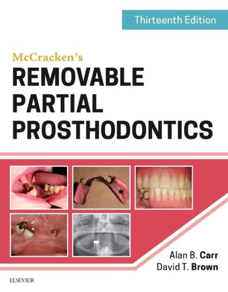 Cover for Carr, Alan B. (Prosthodontic Consultant and Professor of Dentistry in the Department of Dental Specialties) · McCracken's Removable Partial Prosthodontics (Innbunden bok) (2016)