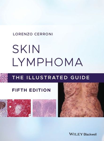 Cover for Cerroni, Lorenzo (Medical University of Graz, Austria) · Skin Lymphoma: The Illustrated Guide (Hardcover Book) (2020)