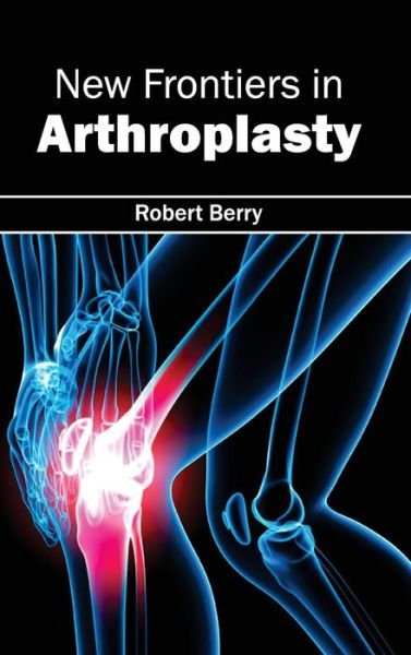 Cover for Robert Berry · New Frontiers in Arthroplasty (Hardcover Book) (2015)