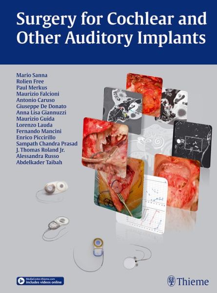 Cover for Mario Sanna · Surgery for Cochlear and Other Auditory Implants (Hardcover Book) (2015)