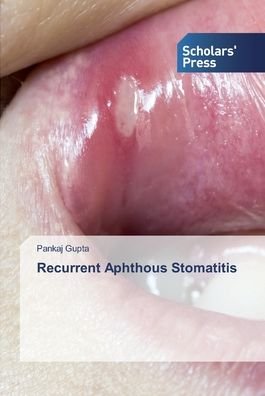 Cover for Gupta · Recurrent Aphthous Stomatitis (Bok) (2020)