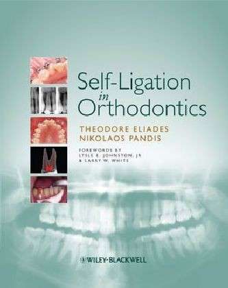 Cover for Eliades, Theodore (Aristotle University of Thessaloniki) · Self-Ligation in Orthodontics (Hardcover Book) (2009)