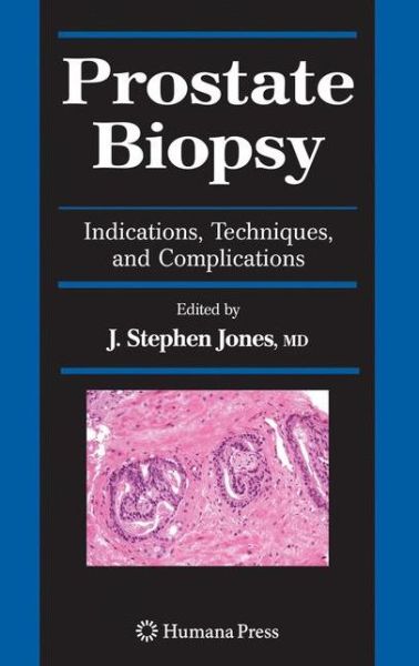 Cover for J Stephen Jones · Prostate Biopsy: Indications, Techniques, and Complications - Current Clinical Urology (Hardcover Book) [2008 edition] (2008)