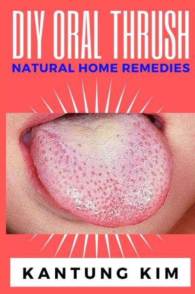 Cover for Kantung Kim · DIY Oral Thrush Natural Home Remedies (Paperback Book) (2020)