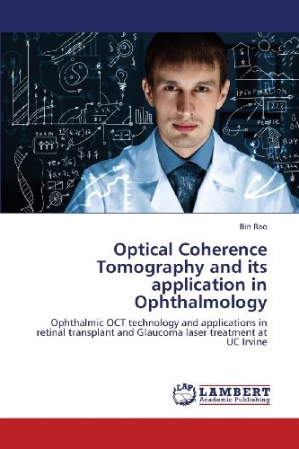 Cover for Bin Rao · Optical Coherence Tomography and Its Application in Ophthalmology: Ophthalmic Oct Technology and Applications in Retinal Transplant and Glaucoma Laser Treatment at Uc Irvine (Paperback Book) (2013)