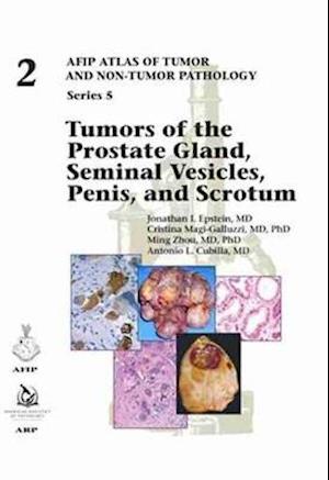 Cover for Jonathan I. Epstein · Tumors of the Prostate Gland, Seminal Vesicles, Penis, and Scrotum - AFIP Atlas of Tumor and Non-Tumor Pathology, Series 5 (Hardcover Book) (2020)